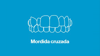 Mordida Cruzada